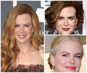 Even Nicole Kidman had her hair color challenges. 